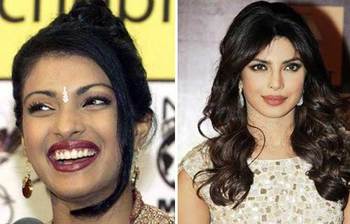 অপারেশন করে চেহারা বদলেছেন যে ৯ বলিউড সুন্দরী