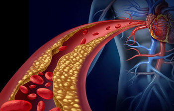 ওষুধ ছাড়া যেভাবে সহজে কোলস্টেরল নিয়ন্ত্রণে রাখবেন