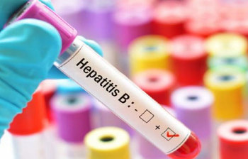 হেপাটাইটিস-বি ভাইরাসে আক্রান্ত হওয়ার লক্ষণগুলো জেনে নিন