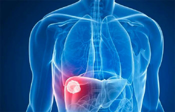 প্রাথমিক পর্যায়ে যে ৭ ধরনের ক্যান্সার ধরা পড়ে না