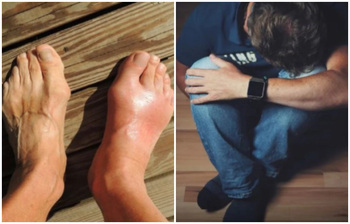 বাতের ব্যথা থেকে মুক্তির সহজ উপায়