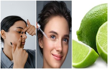 গরমে তৈলাক্ত নাক ও ব্ল্যাকহেডস থেকে মুক্তির উপায়