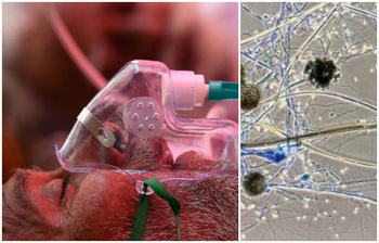 করোনা না হলেও কি ব্ল্যাক ফাঙ্গাসে আক্রান্ত হতে পারেন?