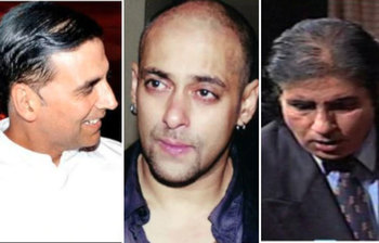 বলিউডের যে তারকারা টাক ঢাকতে হেয়ার ট্রান্সপ্লান্ট করেছেন