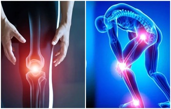 কম বয়সেও ৫ কারণে হাড় দুর্বল হয়