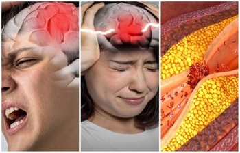 কোন গ্রুপের রক্তের মানুষের স্ট্রোকের ঝুঁকি সবচেয়ে বেশি?