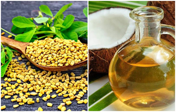 জেনে নিন খুসকির সমস্যা দূর করতে সহজ ৫ উপায়