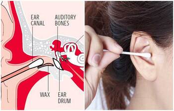 কানে কটন বাড ব্যবহার করলে কী হয়?