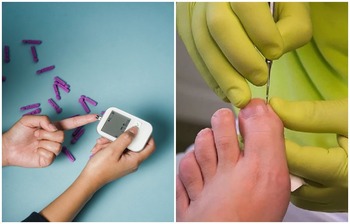 পায়ের যে ৩ লক্ষণে বুঝবেন ডায়াবেটিস হয়েছে