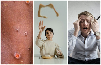 গরমের সময় যেসব রোগে আক্রান্ত হতে পারেন