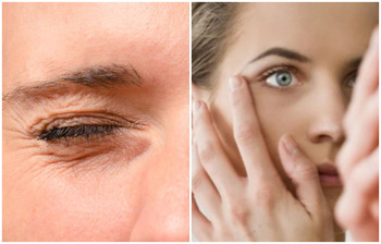 চোখ নাচলে কী করবেন?