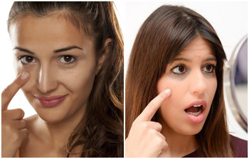 চোখের নিচের কালো দাগ দূর করার সহজ উপায়