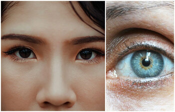 চোখ দেখে যেসব রোগের লক্ষণ বোঝা যাবে