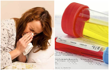 যেসব লক্ষণে বুঝবেন আপনার কিডনিতে পাথর জমেছে