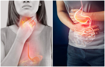 ঘরোয়া উপায়ে গলা-বুক জ্বালাপোড়া দূর করার উপায়