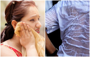 এই গরমে ঘাম কমানোর সহজ উপায়