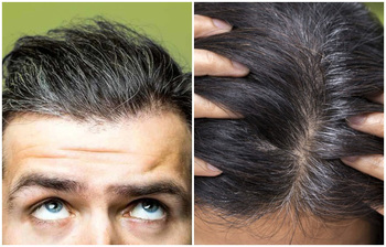 অকালে চুল পাকার জন্য যেসব অভ্যাস দায়ী