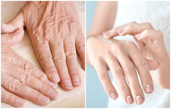 হাতের চামড়া কুঁচকে গেলে যা করবেন
