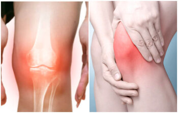 ৫ মিনিটে দূর করুন হাঁটুতে ব্যথা