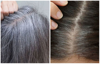 পাকা চুল টেনে তুললে কী হয়?