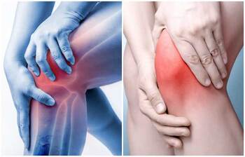 হাঁটুর ব্যথা দূর করার ঘরোয়া উপায়