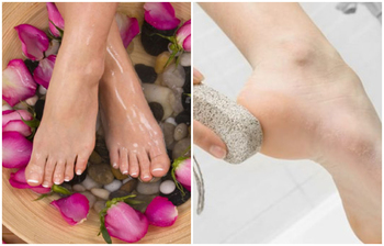 শীতের সময় পায়ের পাতা ও গোড়ালি ফাটা দূর করবেন যেভাবে