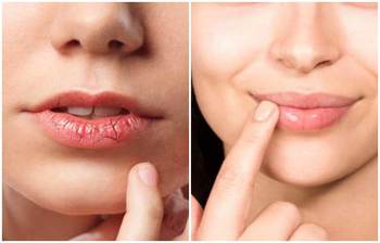 শীতের সময় ঠোঁট নরম রাখার সহজ উপায়