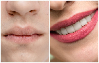 শীতের আগেই ঠোঁট ফাটা থেকে রক্ষার ঘরোয়া উপায়