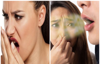 মুখের দুর্গন্ধ দূর করার সহজ উপায়