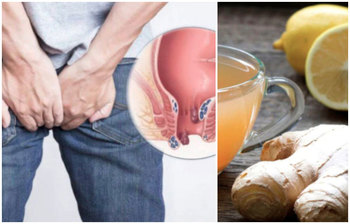 ওষুধ ছাড়া ঘরোয়া উপায়ে পাইলস সারাবেন যেভাবে