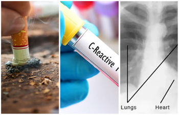 ধূমপায়ীদের যে পরীক্ষাগুলো করানো উচিত