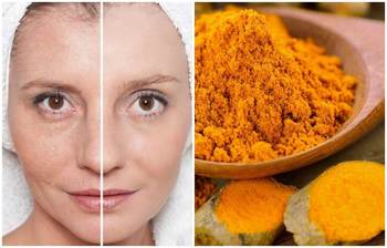 শীতে শরীরে হলুদ ব্যবহারে যেসব গুরুত্বপূর্ণ উপকার পাবেন