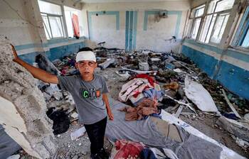 তীব্র অপুষ্টিতে ভুগছে গাজার শিশুরা