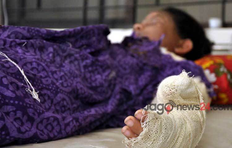 রাজধানীর কলাবাগানে শনিবার গ্যাসলাইন বিস্ফোরণে নারী ও শিশুসহ ৭ জন দগ্ধ