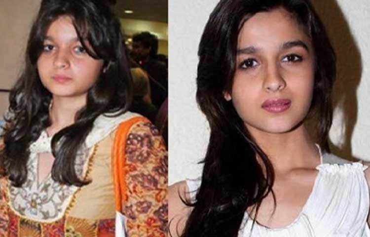 আলিয়া ভাট