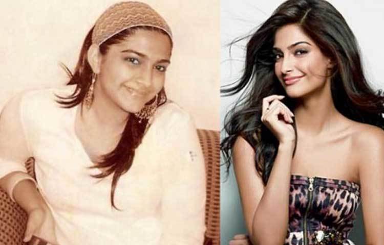 সোনম কাপুর মেকাপ ব্যাবহারের আগে ও পরে