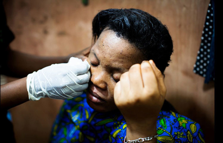 দেশীয় গাছ-গাছড়া দিয়ে তৈরি ক্রিম দিয়ে ব্রণ দূরীকরণের জন্য বিউটিপার্লারে উগান্ডার এক তরুণী। ছবি : সিএনএন