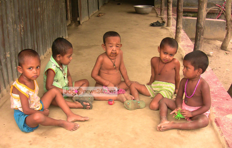 বায়েজিদের বাবা লাবলু শিকদার জাগো নিউজকে জানান, অনেক ডাক্তার কবিরাজ দেখিয়েও কোনো ফল পাওয়া যায়নি। রোগের কারণ অনুসন্ধান করতে পারেনি স্থানীয় চিকিৎসকরা। ছবি : আরাফাত হোসেন।