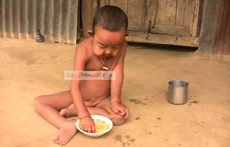 শিশু বায়েজিদের মা তৃপ্তি খাতুন বলেন, স্বাভাবিকভাবে শিশুরা ১০ মাসে হাঁটা শিখলেও বায়েজিদ সাড়ে তিন বছরে হাঁটতে শিখেছে। আবার তিন মাস বয়সে তার সব দাঁত উঠে গেছে। ছবি : আরাফাত হোসেন।