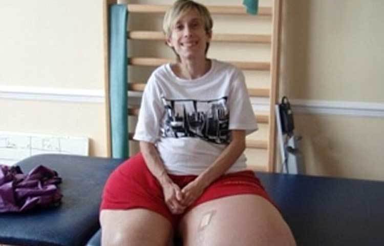 ম্যান্ডির গোটা শরীরের ওজন ১৩৩ কেজি। তার মধ্যে তার দু&rsquo;টি পায়ের ওজনই ৯৫ কেজি।