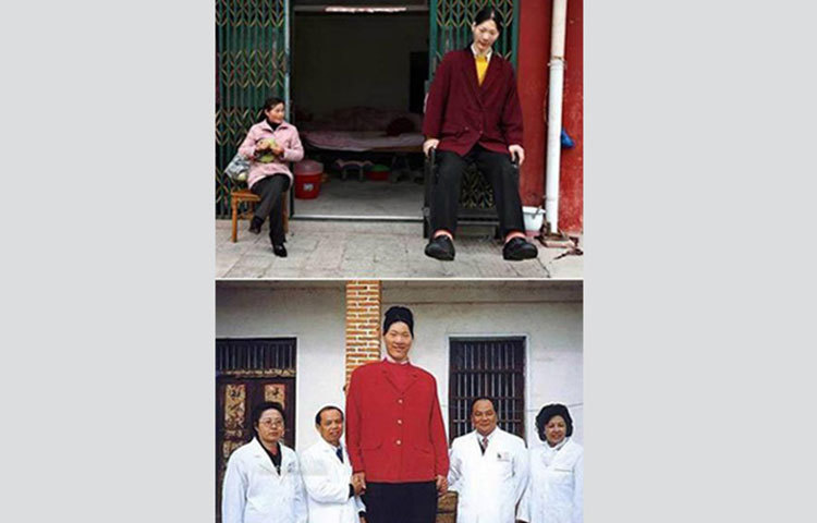 চীনের ইয়াও ডিফেন ৭ ফুট ৮ ইঞ্চি উচ্চতা নিয়ে বর্তমানে বিশ্বের সবচেয়ে লম্বা নারীর অবস্থানে রয়েছেন। পিটুইটারি গ্ল্যান্ড এ টিউমারই তার এই অস্বাভাবিক উচ্চতার কারণ বলে জানা গেছে।