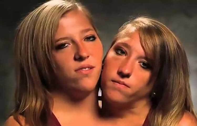 এরা আসলে যমজ। কিন্তু গর্ভাবস্তা থেকেই এরা এক শরীর এবং দুই মাথা নিয়ে বড় হচ্ছেন। অ্যাবিগেল এবং ব্রিটনি জন্মগত ভাবে মার্কিন।