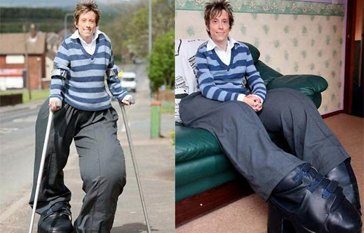 ম্যান্ডি সেলার্স : ইনি হলেন পৃথিবীর সবচেয়ে বড় পায়ের অধিকারিনী। জিনঘটিত রোগের কারণেই তার দু&rsquo;পায়ের এই অস্বাভাবিক বৃদ্ধি।