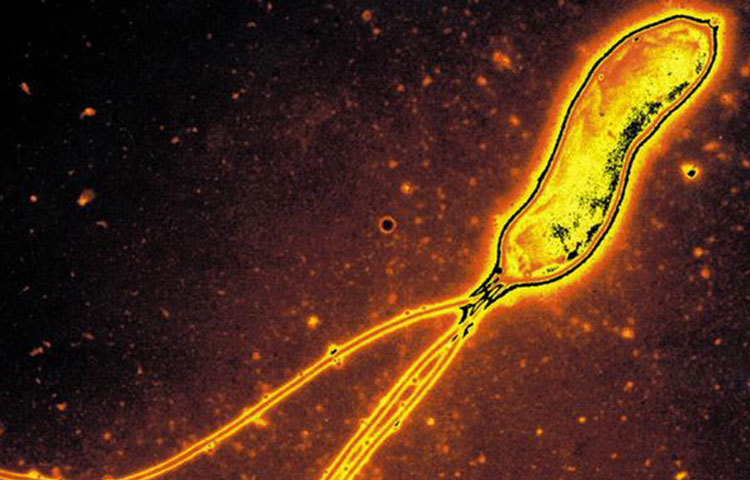 ইনফেকশনের মাধ্যমে ক্যানসার হতে পারে। তবে বিভিন্ন সংক্রমণ থেকে মুক্ত রাখতে টিকা বা অ্যান্টিবায়োটিকও নেয়া যেতে পারে।