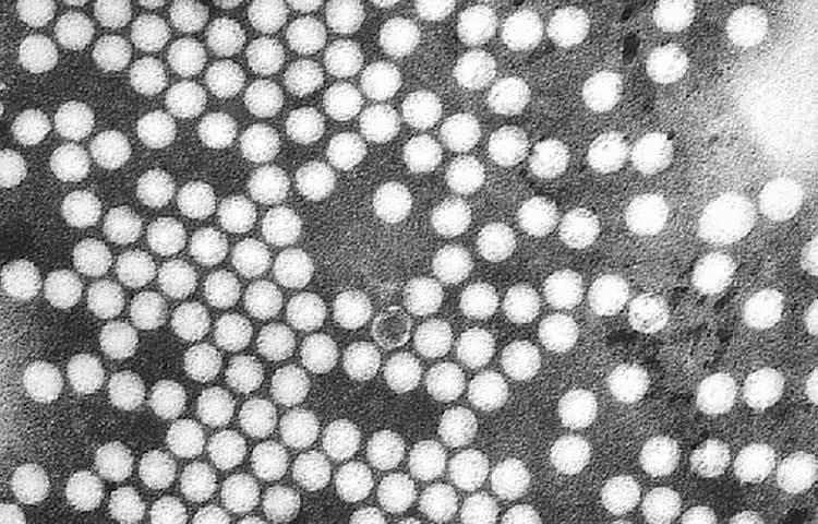 পোলিও : এই অসুখটিও এখন প্রায় ‘বিরল’ হয়ে গিয়েছে। অথচ এক সময় এই অসুখে আক্রান্ত হয়েছে সারা পৃথিবীর শিশুরা।