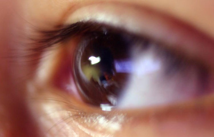 চোখে কম দেখা বা ঝাপসা দেখাও ডায়াবেটিসের উপসর্গ।