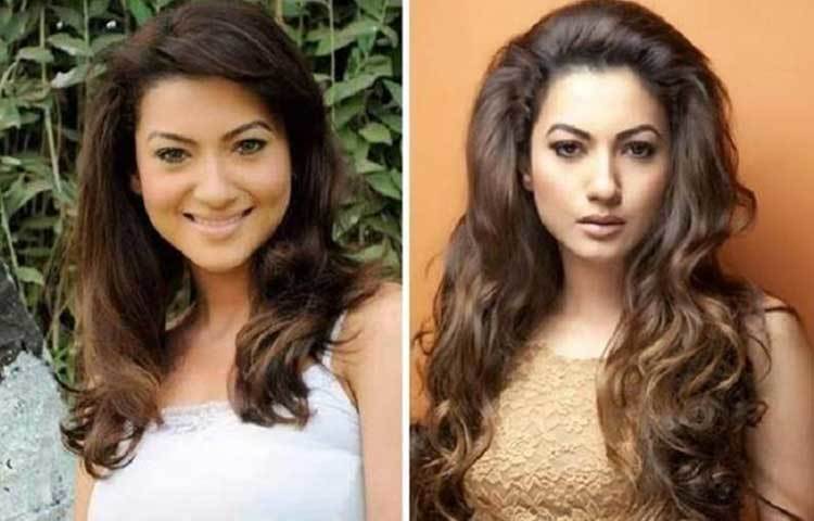 গৌহর খান : তিনিও ঠোঁটে প্লাস্টিক সার্জারি করিয়েছেন বলে কানাঘুষো শোনা যায়।