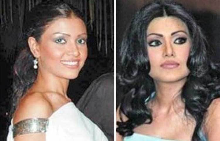 কোয়েনা মিত্র : এ নায়িকা নাক, ঠোঁট, গাল ও ভ্রু পুরোটাই প্লাস্টিক সার্জারি করিয়েছেন।