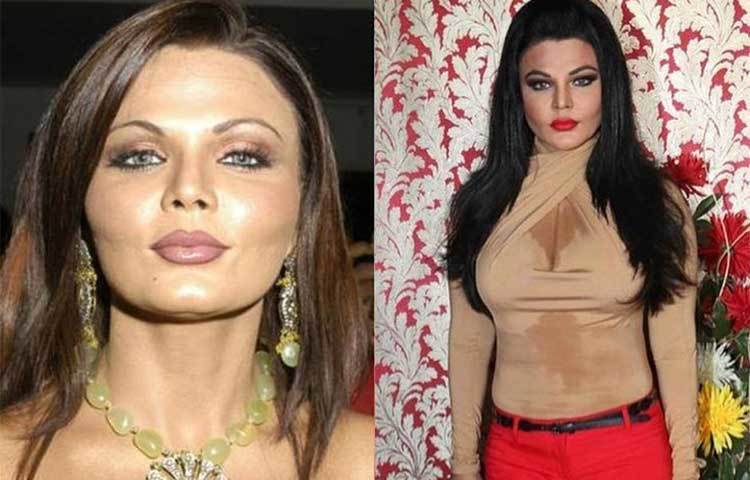 রাখী সায়ন্ত : তিনিও ঠোঁটে সার্জারি করিয়েছেন বলে শোনা যায়।