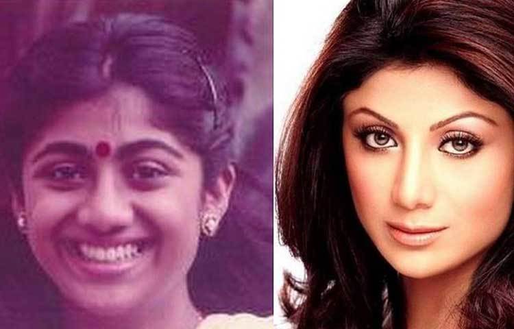 শিল্পা শেটি : একেবারেই নিজেকে বদলে ফেলেছেন শিল্পা শেটি। নাক ও ভ্রু হাড়ে অস্ত্রোপচার করেছেন তিনি।